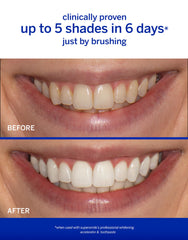 Supersmile pre rinse icy finish preps enamel for whitening
