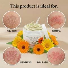 Sweetsation Therapy Calendula Cream application showing gentle moisturizing.
