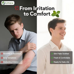 Umex Intensive Itch Relief Cream in bag for portable use and quick relief
