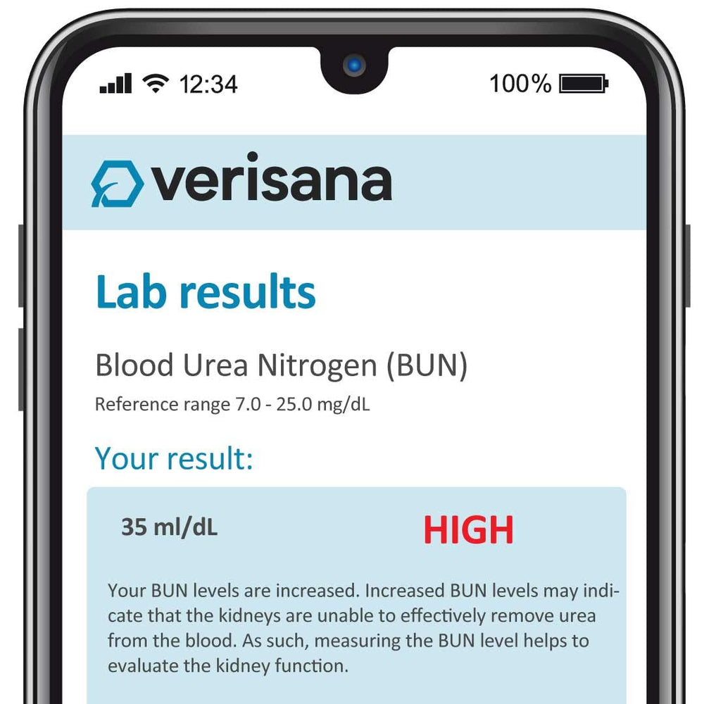 Verisana at-home sample collection demonstrates simple steps for accurate kidney health testing