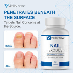 Vitality Now Nail Exodus two-pack packaging emphasizing value and ongoing use