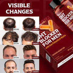 Vivaravida DHT Blocker biotin vitality highlight