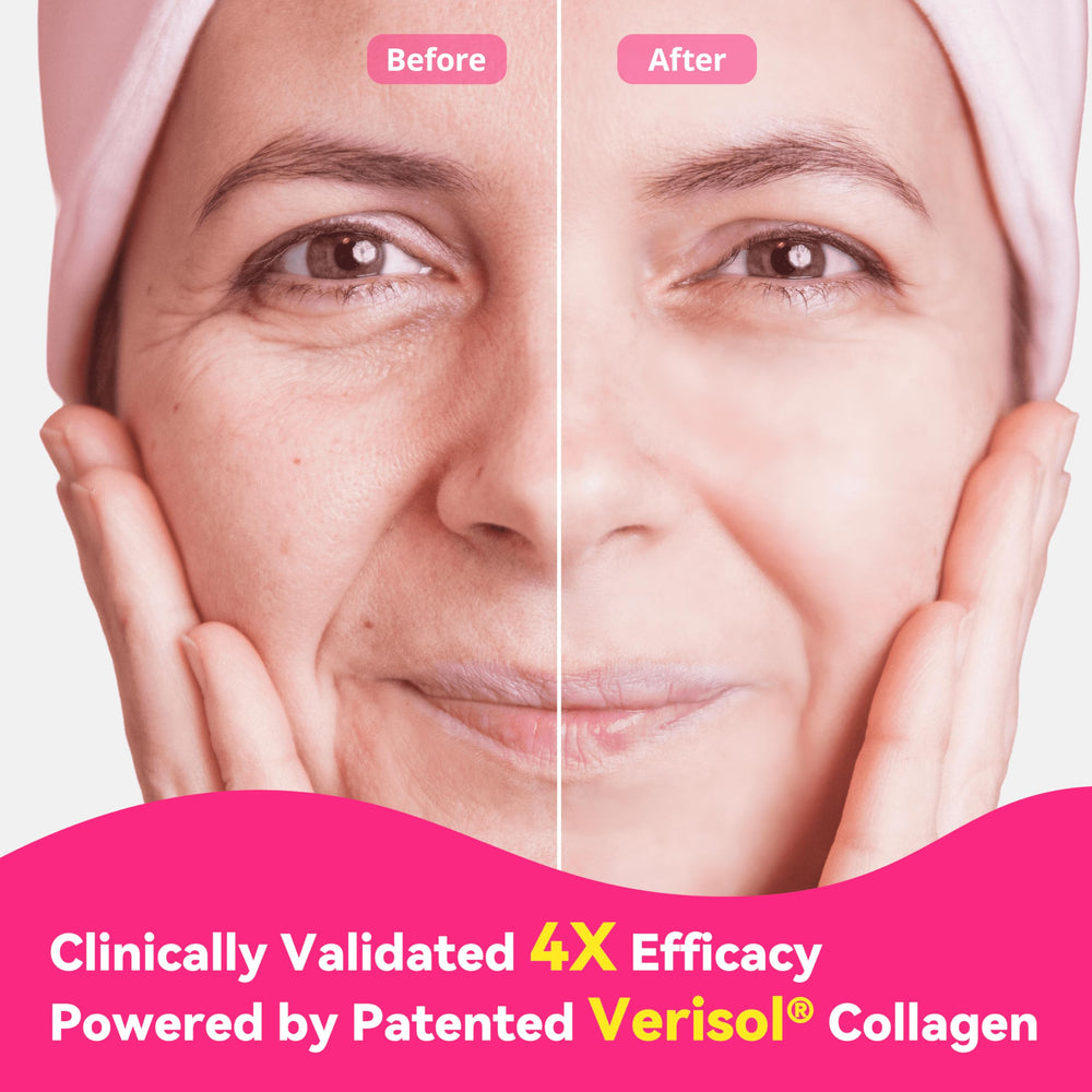 VIVI Youth collagen powder sachets ready for on-the-go use