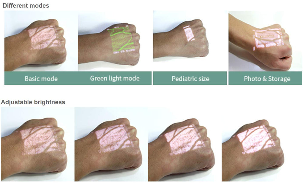 Vivolight Vein Viewer Pro in-use with patient arm, illuminator highlights visible veins.