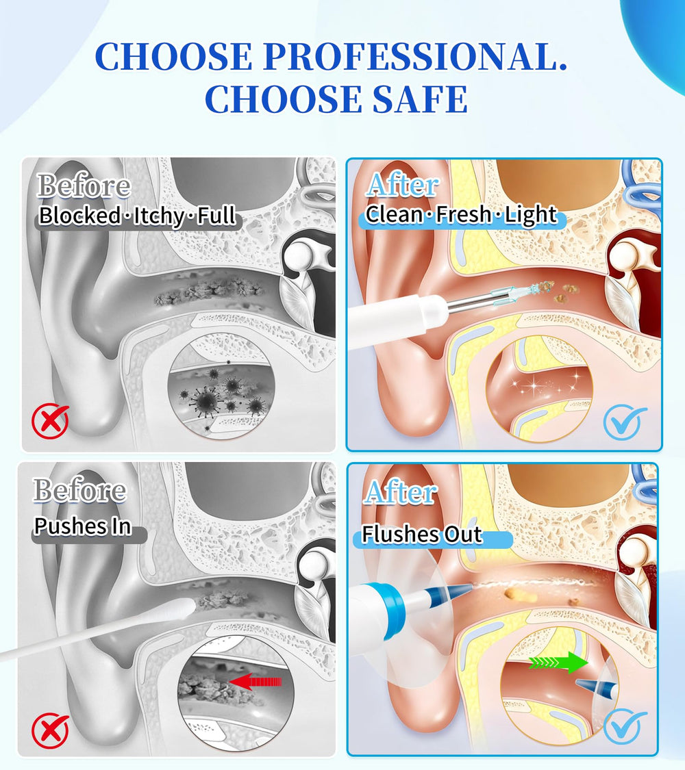 WisePulse ear-cleaner-4-pressure-settings demonstrates adjustable flow control.