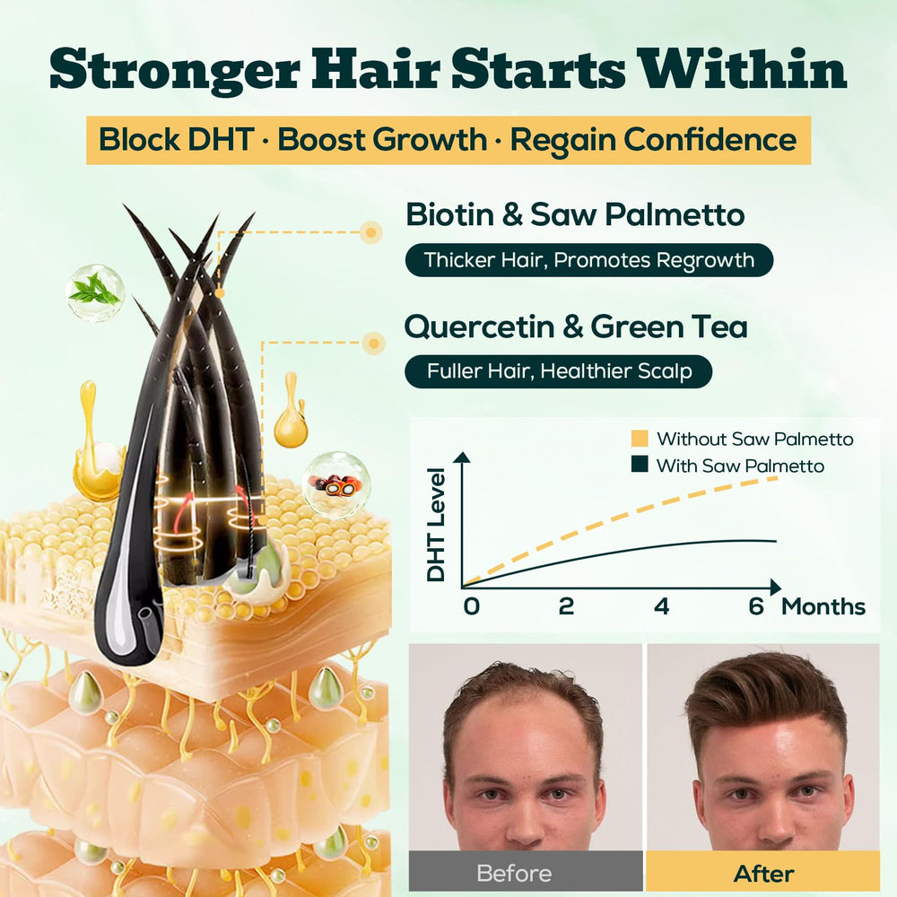 YLVARIN THORIA Saw Palmetto Gummies label close-up shows high-strength formula