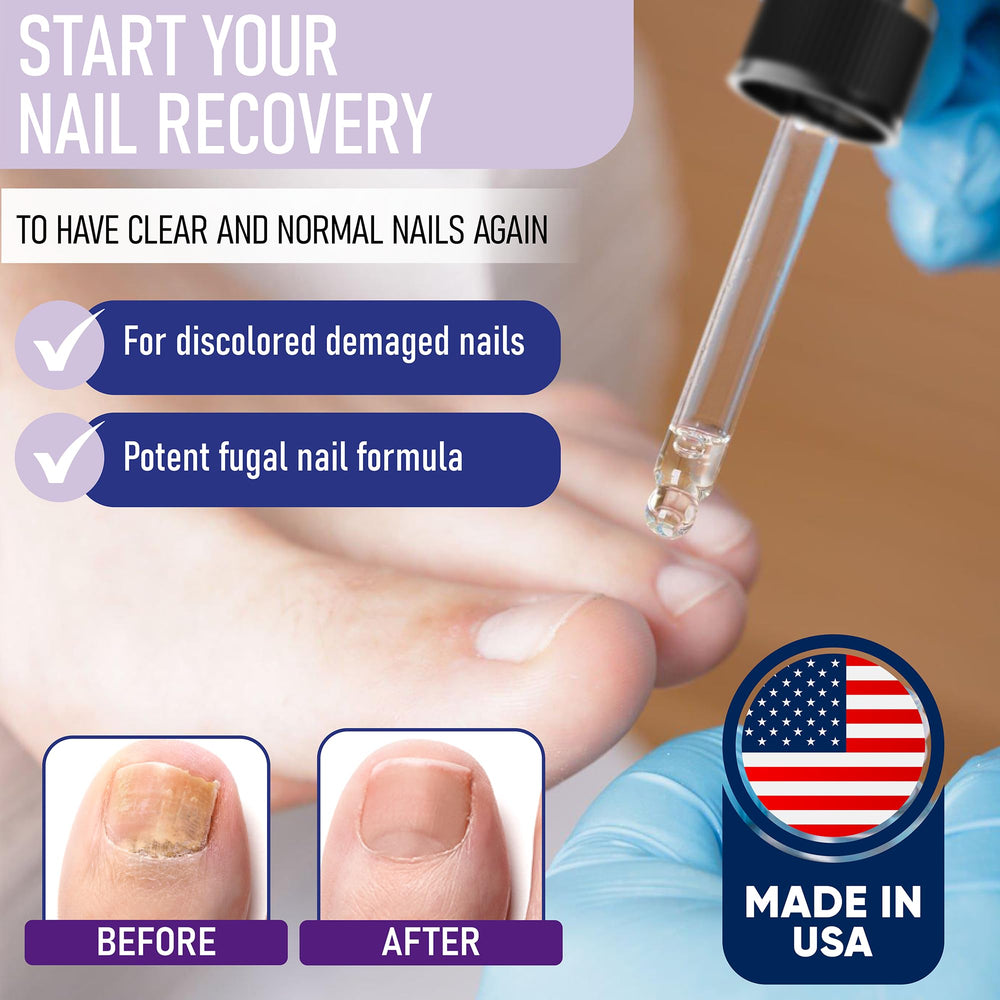 ZanaQuick nail recovery drops application demonstrates easy daily use for healthier nails.