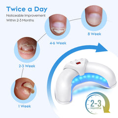 ZZP New Nail Fungus Device plugged in for home use.