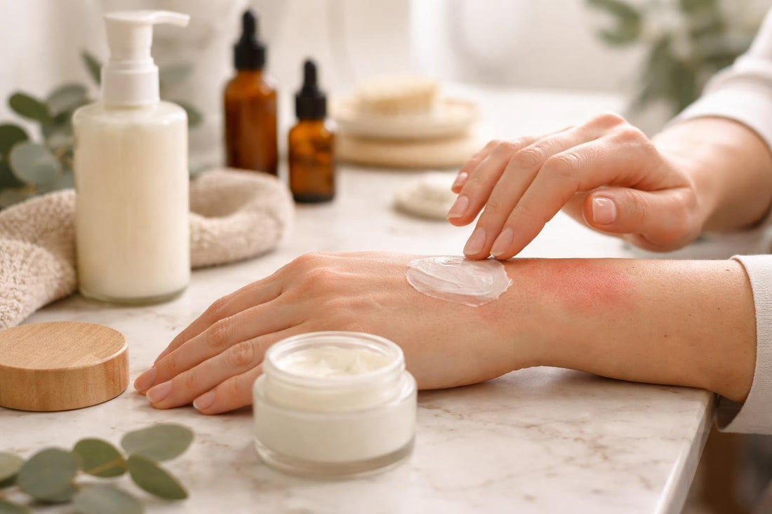 hands applying soothing balm to irritated skin