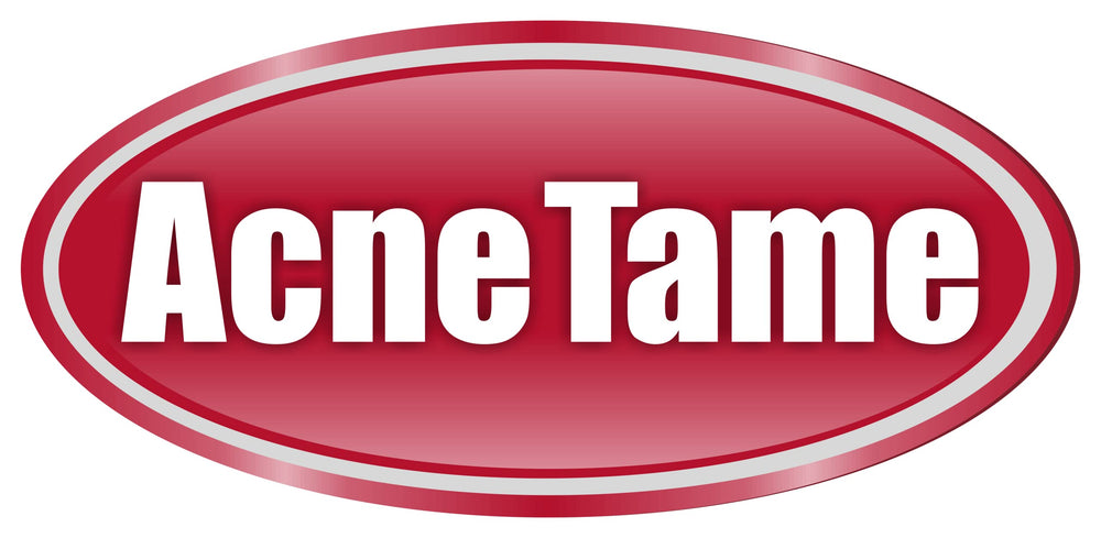 Acnetame pills on a clean backdrop suggest balanced oil and supporting complexion.