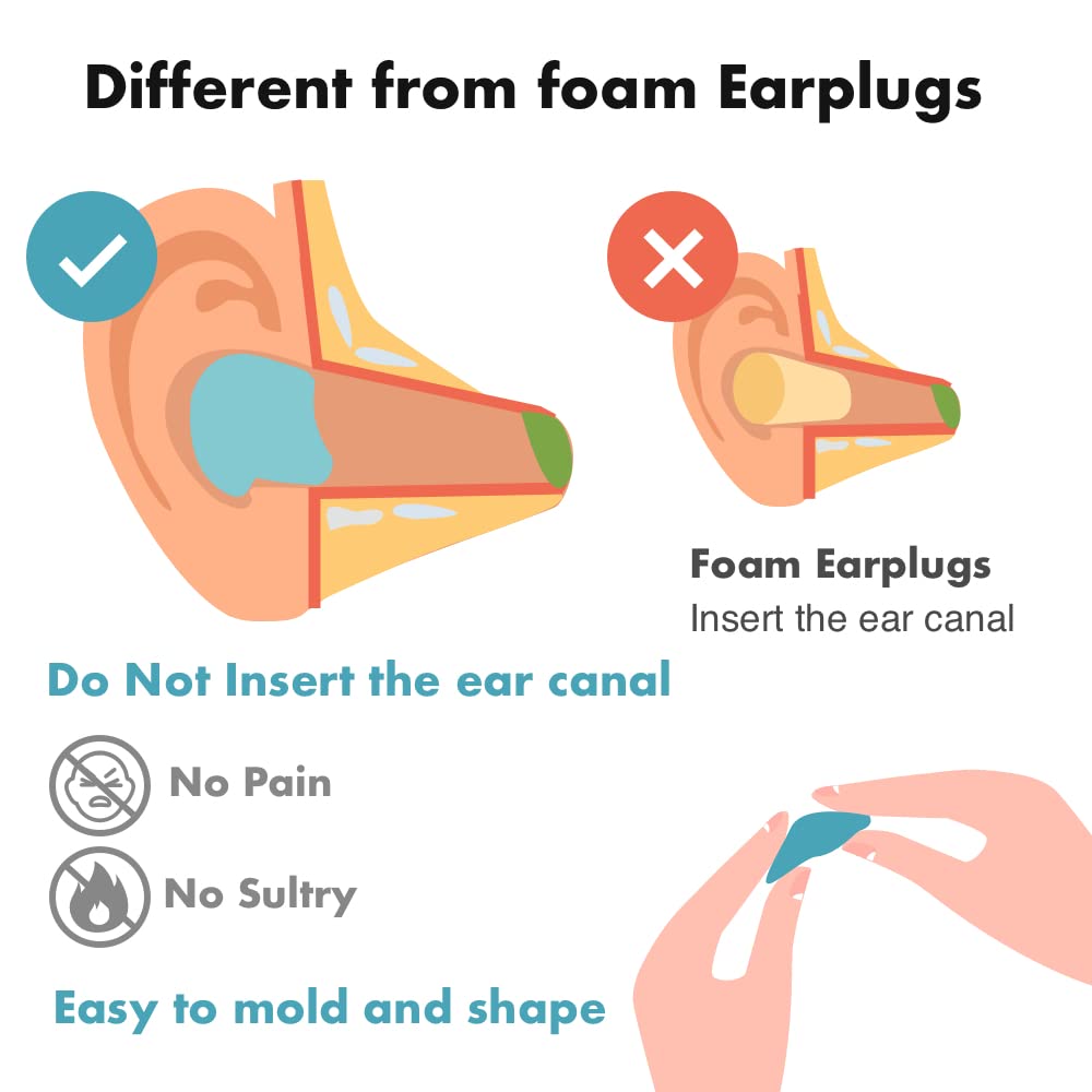 Acousdea moldable ear plugs fit any ear size for custom comfort