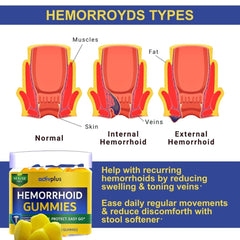 ACTIV PLUS Hemorrhoid Gummies ingredients chart features seven key components for vascular support.