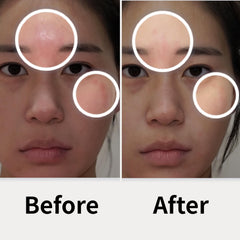 AD SOLUTION ATO Fast Calming patches close-up highlighting gentle hydrogel texture for sensitive skin.