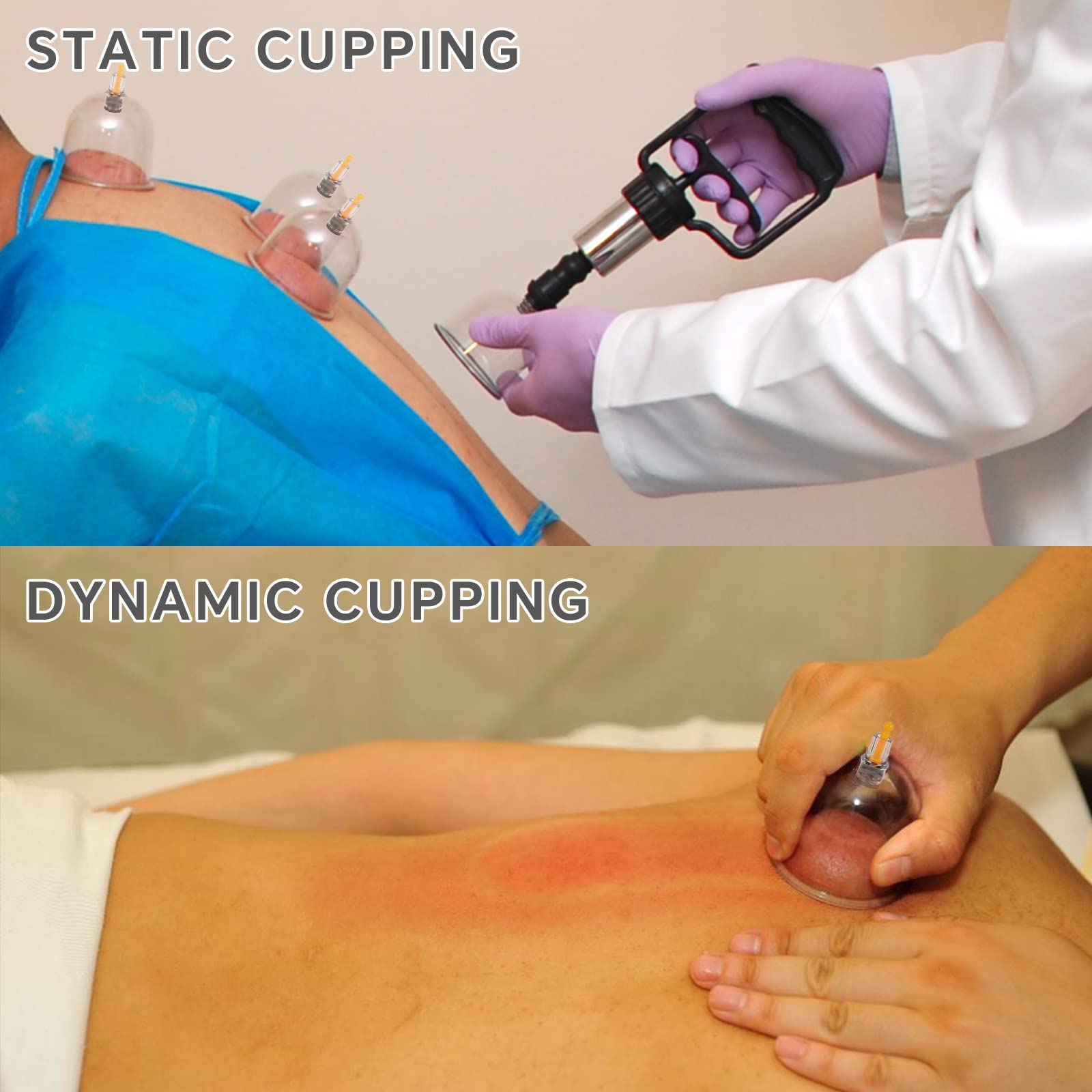 AIKOTOO cupping set safety features enable comfortable self treatment