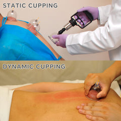 AIKOTOO cupping set safety features enable comfortable self treatment