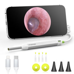 AnyScope HD Otoscope in silver product shot highlighting portable design for home use