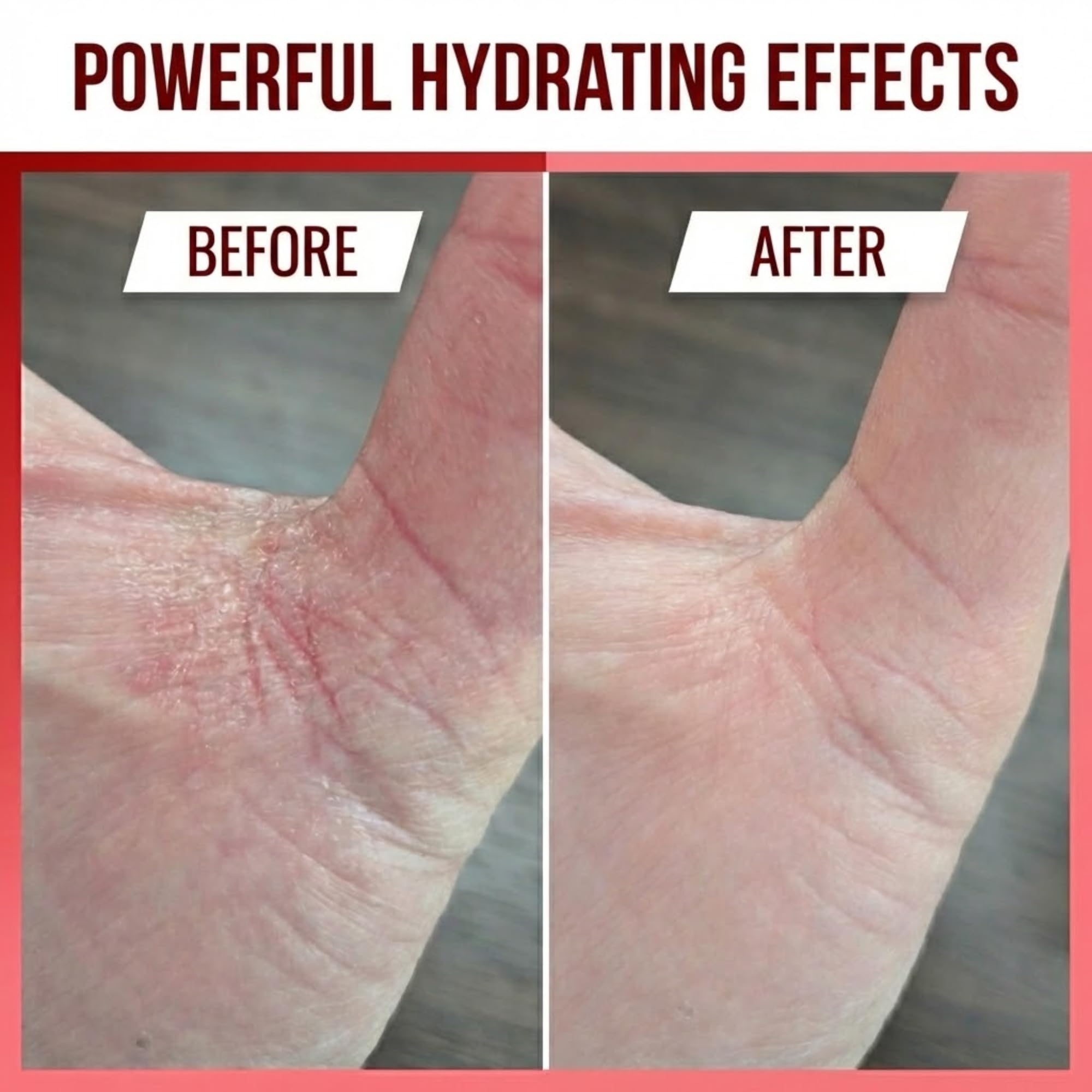 Colloidal oatmeal in the Eczaprin balm base