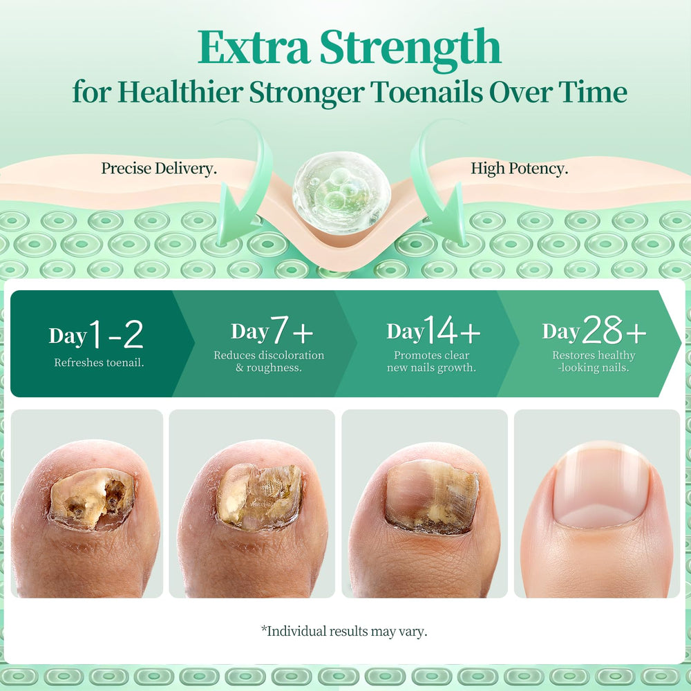 APUREE Dual-Core Formula combines actives for comprehensive toe nail care.