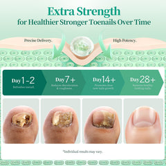 APUREE Dual-Core Formula combines actives for comprehensive toe nail care.