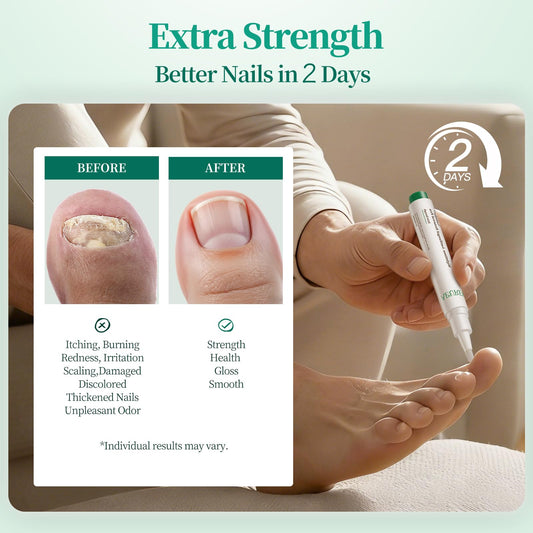 APUREE Night Pen overnight renewal nourishes nails while you sleep.
