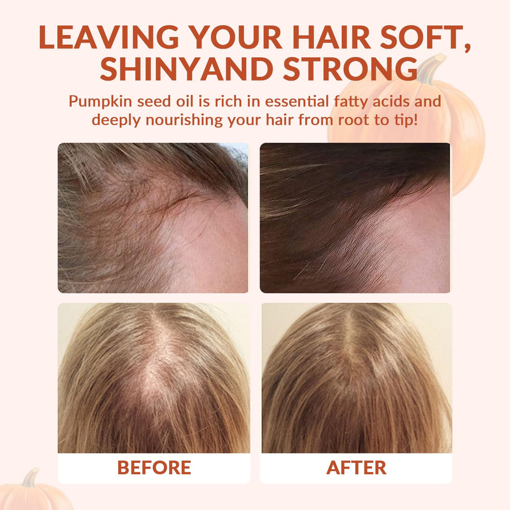 ARSYCHLL Hair growth support visual with capsules suggesting nourishing benefits