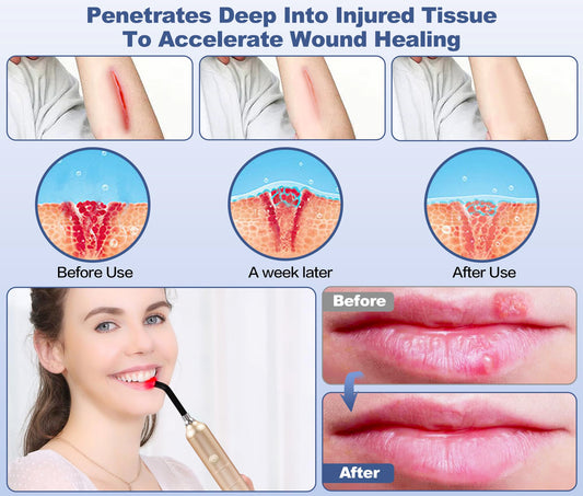 Aswaysun facial tip-on red light therapy for nose and ear areas