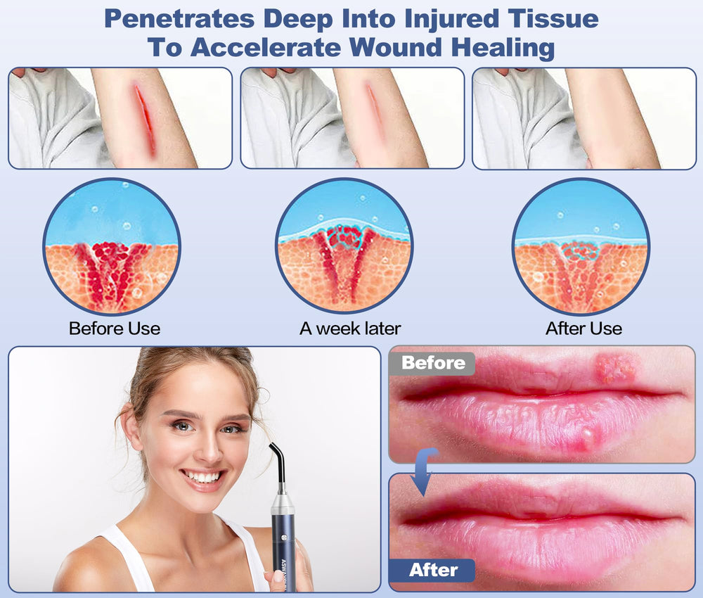 Aswaysun infrared wand with tips attached for versatile facial and body therapy.