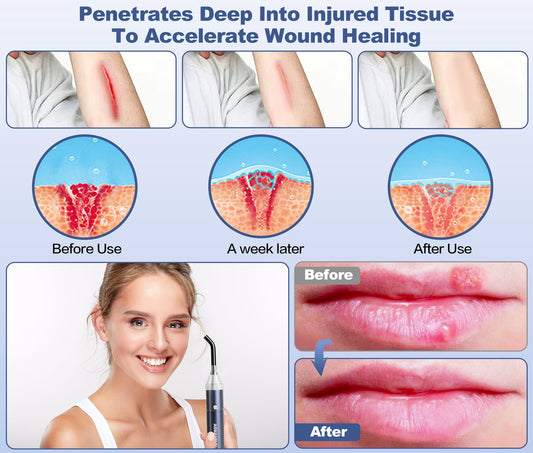 Aswaysun infrared wand with tips attached for versatile facial and body therapy.