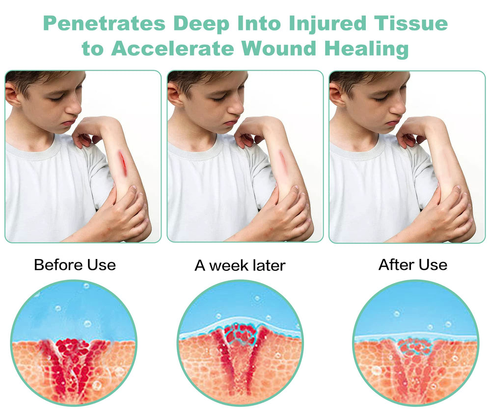 ASWAYSUN portable device used on knee for targeted joint relief