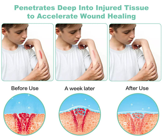 ASWAYSUN portable device used on knee for targeted joint relief