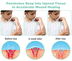 ASWAYSUN portable device used on knee for targeted joint relief