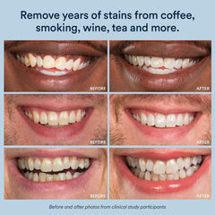 Graphic indicates enamel-safe formula compatible with crowns and veneers.