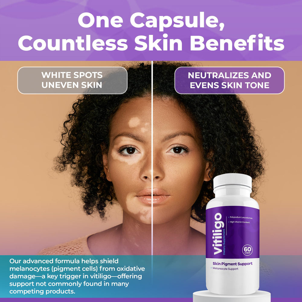 Aura Vitamins Vitiligo Capsules produced in GMP-certified facility ensuring quality