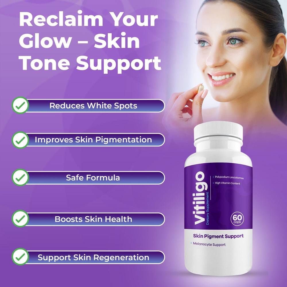 Aura Vitamins Vitiligo Capsules packaging highlights safe daily pigment support