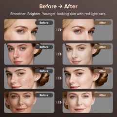 Balnore 850nm infrared enhances deep skin reach for thorough coverage