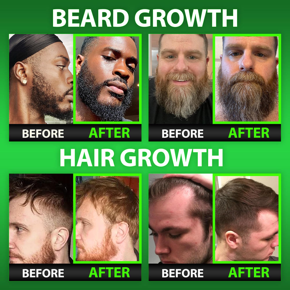 BBS Best Beard Stuff gummy close-up shows potent biotin for thicker beard.