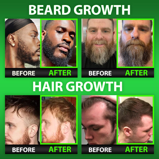BBS Best Beard Stuff gummy close-up shows potent biotin for thicker beard.