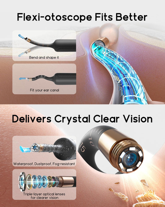 BEBIRD Earsight Plus bendable otoscope enables flexible access to hard-to-reach ear canals.