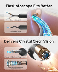 BEBIRD Earsight Plus bendable otoscope enables flexible access to hard-to-reach ear canals.