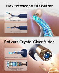 BEBIRD Earsight Plus painless tweezers help lift debris without scraping delicate ear walls.