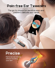 BEBIRD Earsight Plus soft silicone coating ensures comfortable use during detailed ear checks.
