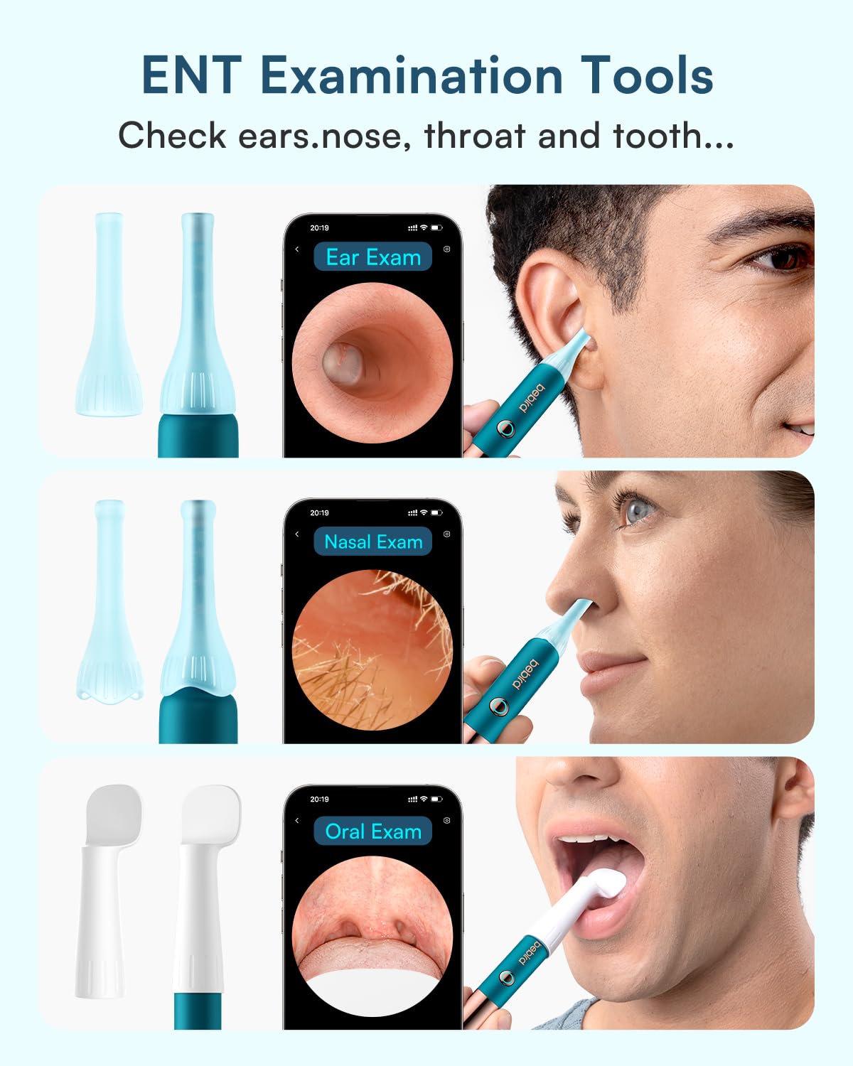 Two‑year warranty and comprehensive support for BEBIRD EarSight Ultra