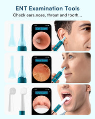 Two‑year warranty and comprehensive support for BEBIRD EarSight Ultra