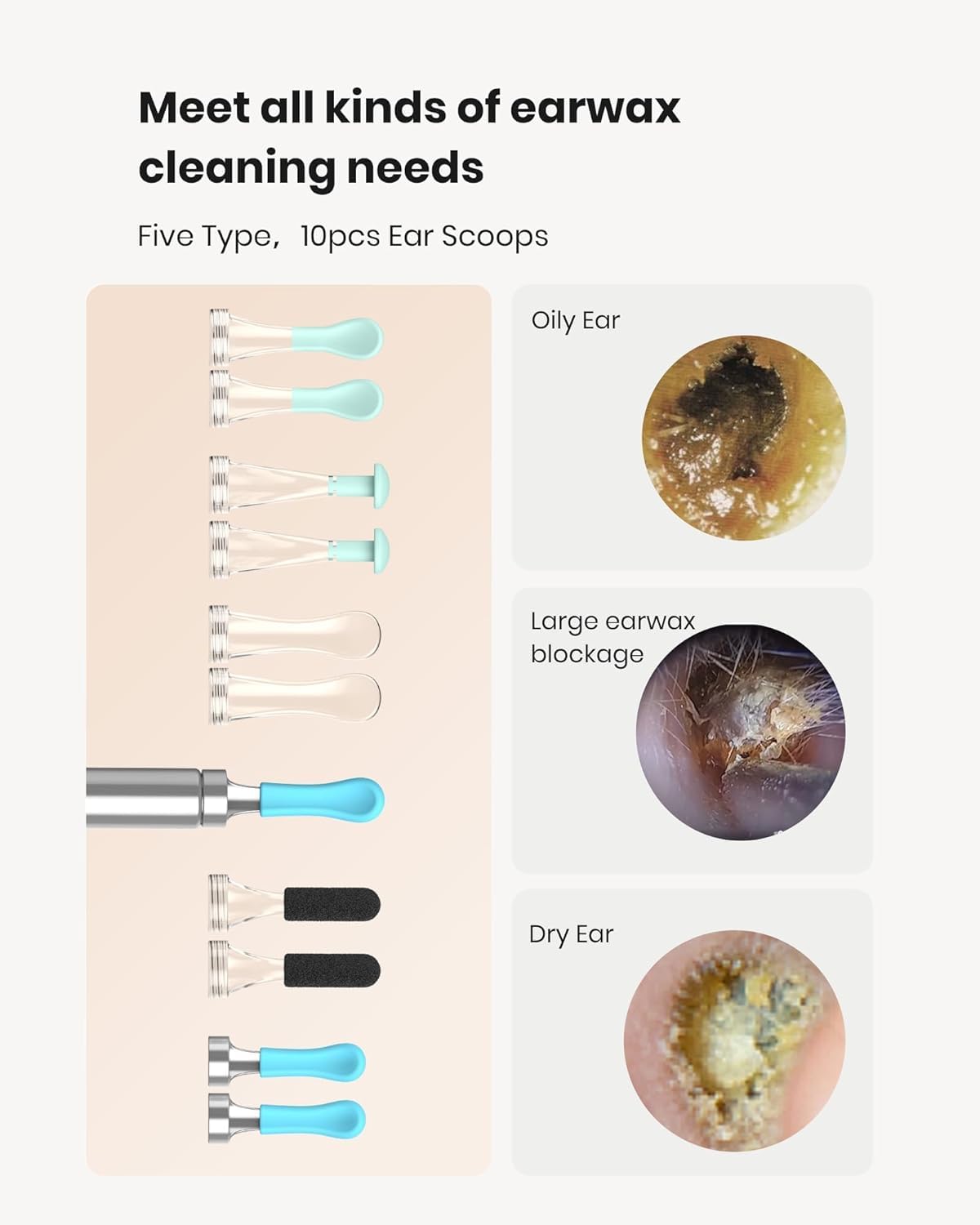 BEBIRD R1 app view shows real-time feed and lets you save clips for reference.