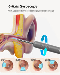 BEBIRD R1 includes multiple replacement tips for dry or oily ear wax care.