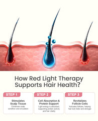 Beloving cordless scalp cap battery-powered operation for wireless use.