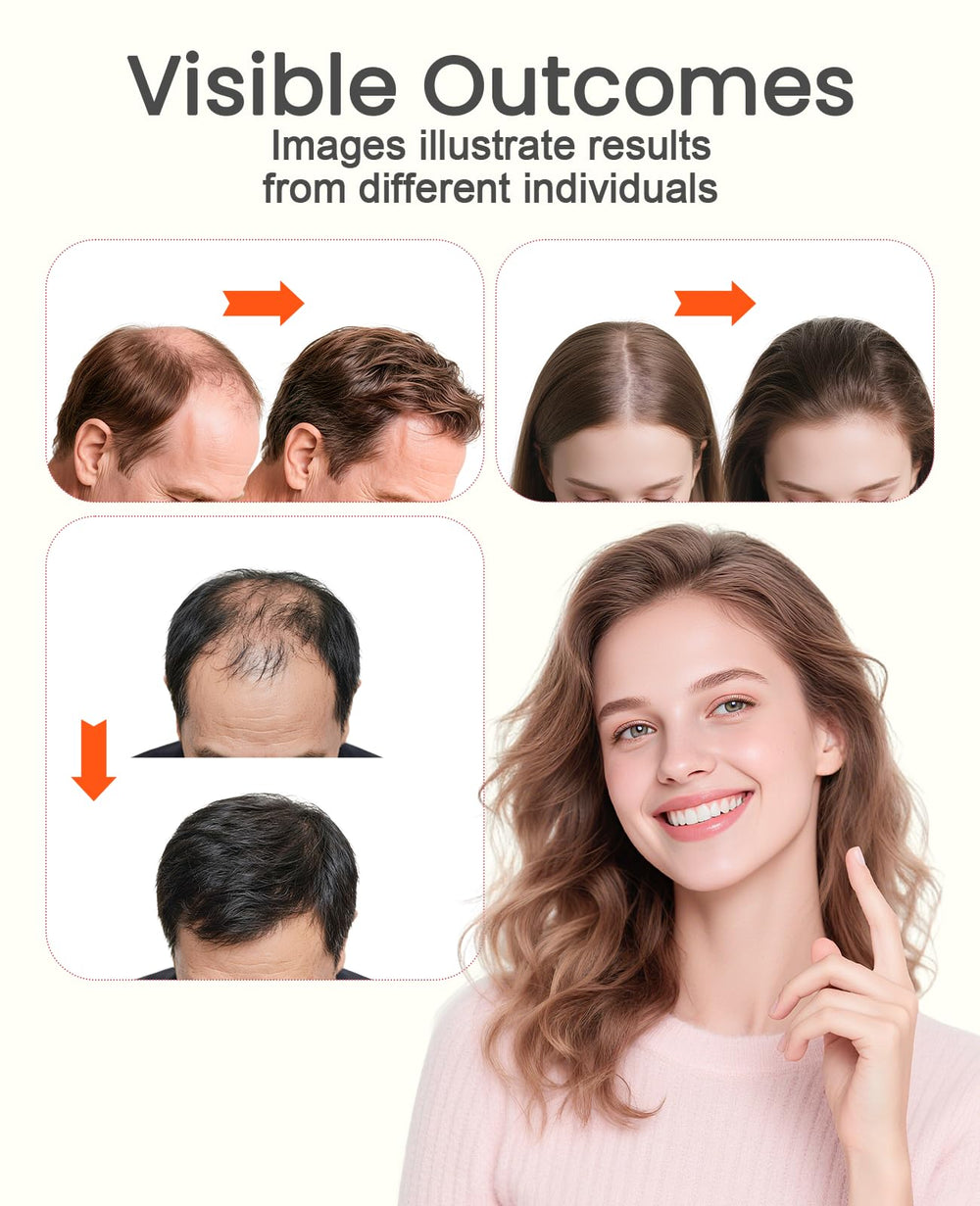 Beloving cordless scalp cap soft breathable materials for long-wear comfort.