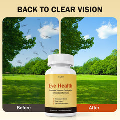 Besgiful Eye Supplement capsules spilled on white surface suggest easy dosing.