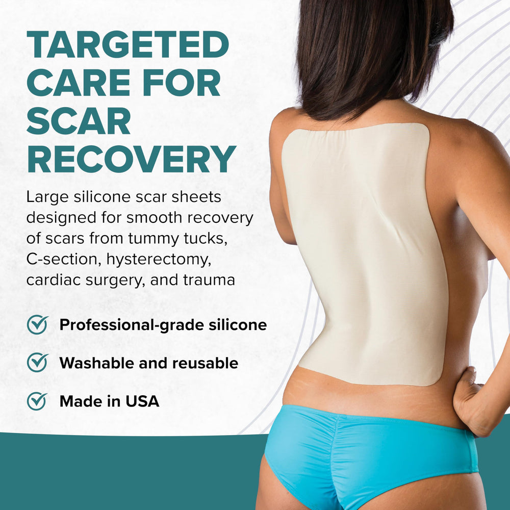 The EpiDerm large silicone sheet can be cut to fit scar shapes.