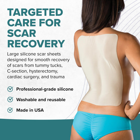 The EpiDerm large silicone sheet can be cut to fit scar shapes.